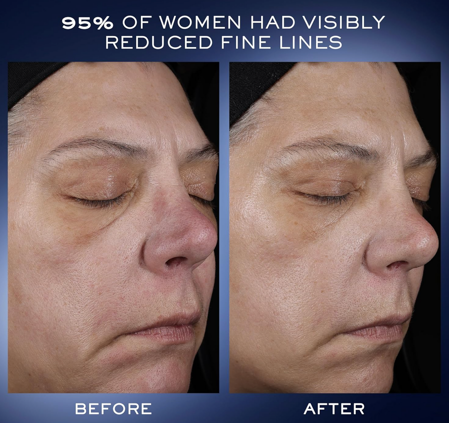 LANCOME Advanced Genifique Youth Activating Concentrate Serum 30ml