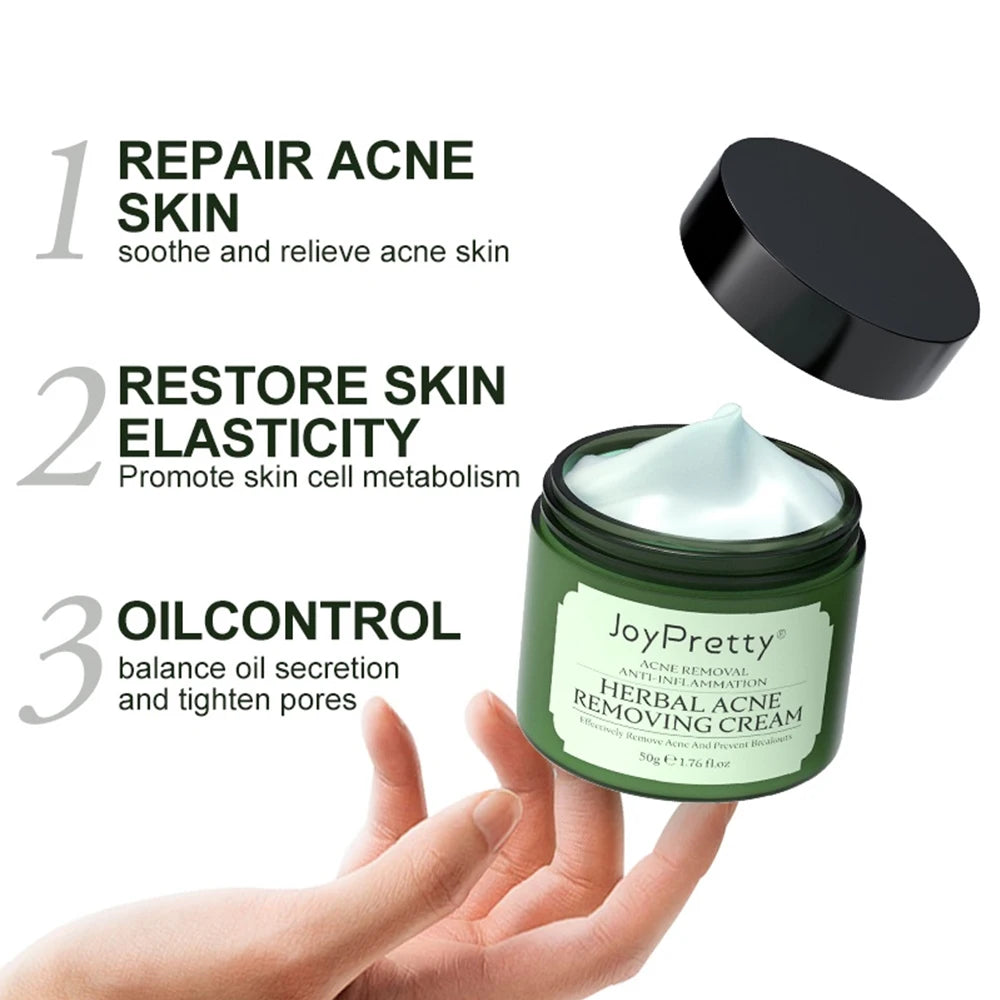 JOYPRETTY Herbal Acne Face Cream Body 50ml