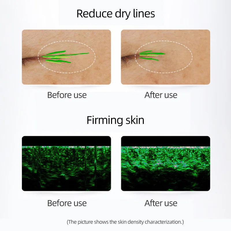 MURAD omega essence repairs, nourishes, moisturizes, anti-wrinkle, firming and soothing 30ml