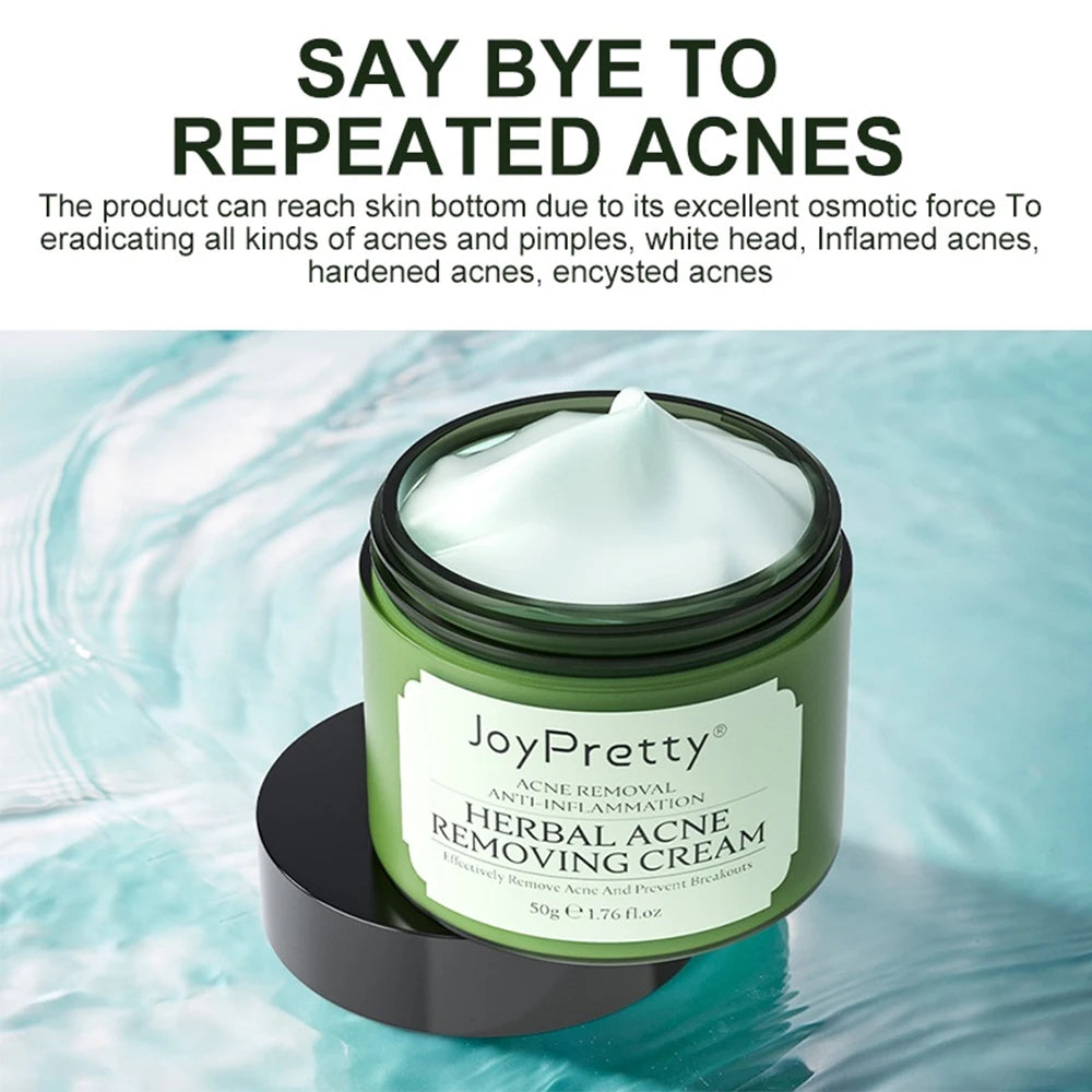 JOYPRETTY Herbal Acne Face Cream Body 50ml